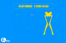 X - veida kājas - ko ņemt vērā treniņos